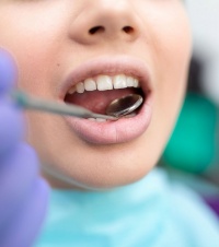 Лечение острого периодонтита зуба в стоматологии